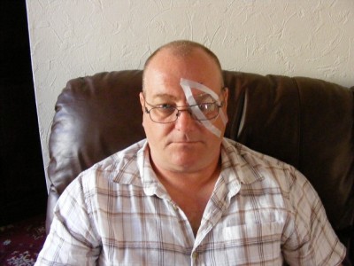 Me after my eye op 29/6/10