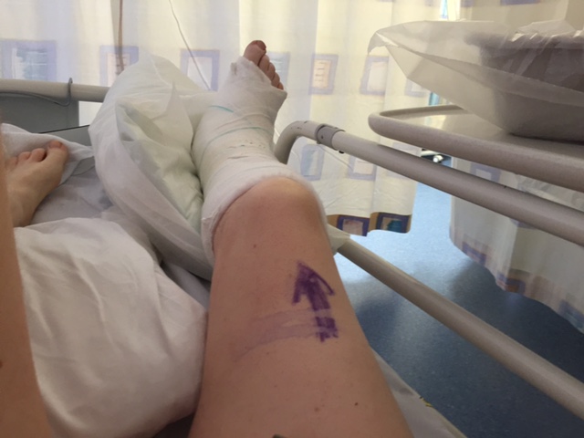 Ouch...there are better ways of getting legless!